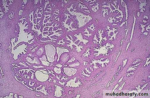 Genital Tract