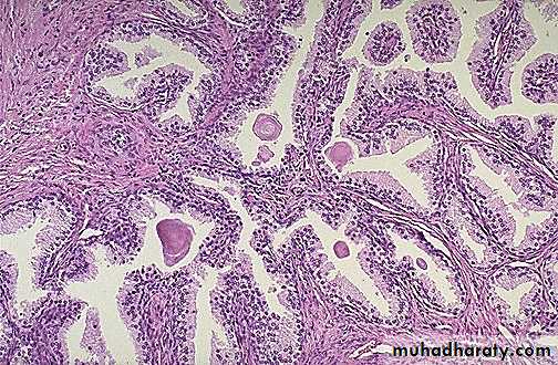 Genital Tract