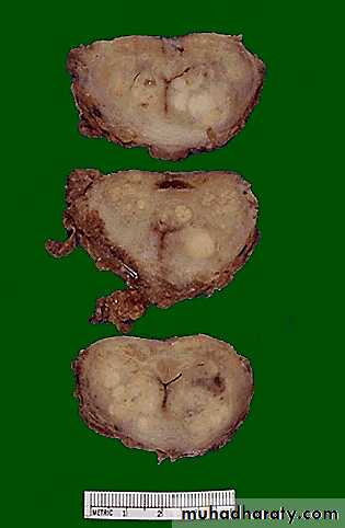 Genital Tract