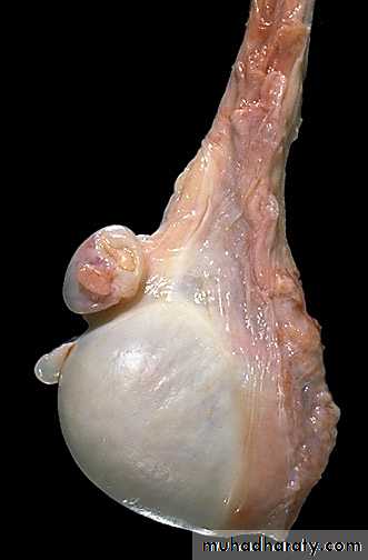 Genital Tract