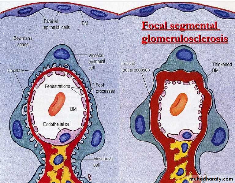 Renal