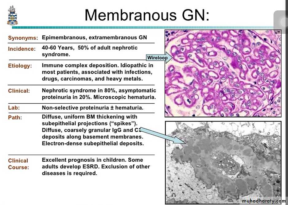 Renal