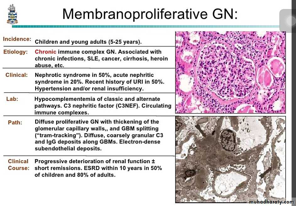 Renal