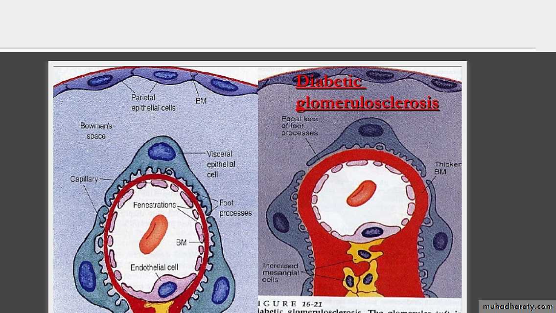 Renal