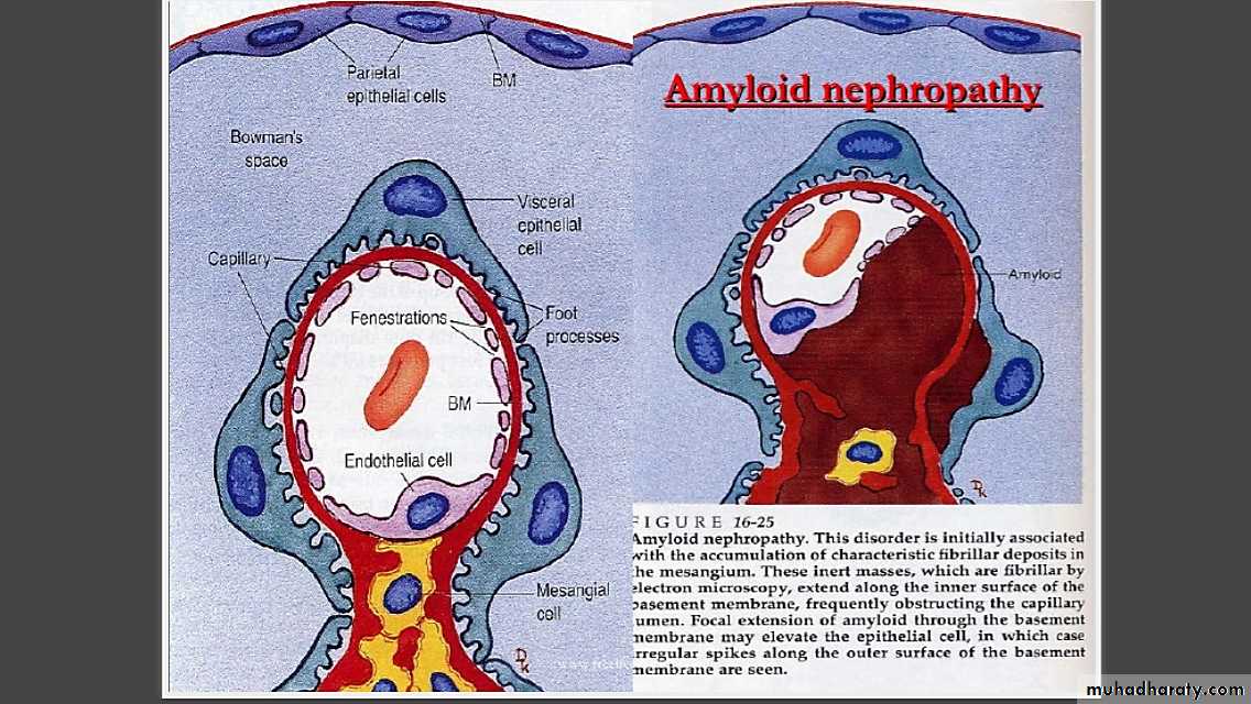 Renal