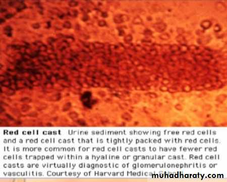 Renal