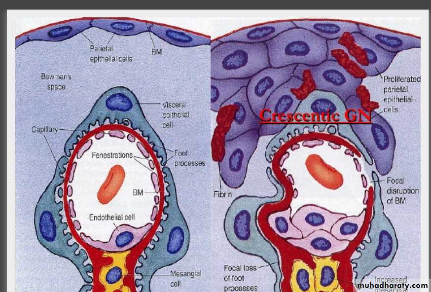 Renal