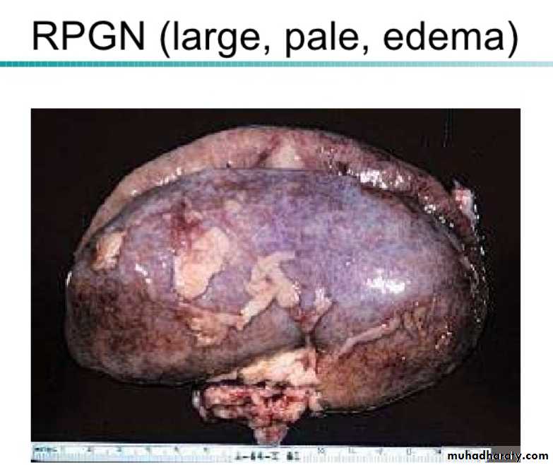 Renal