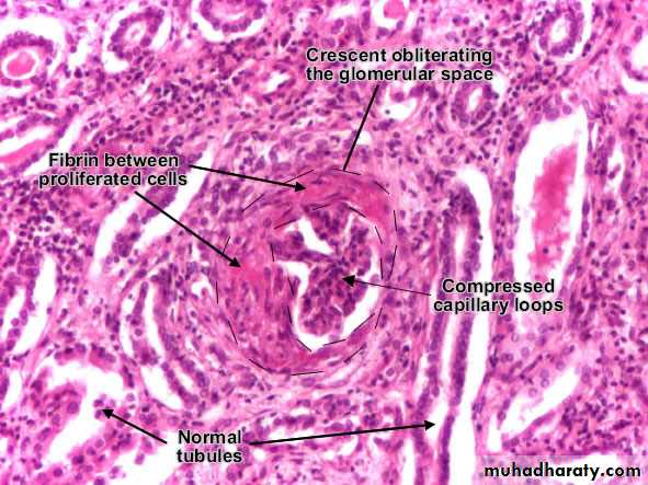 Renal