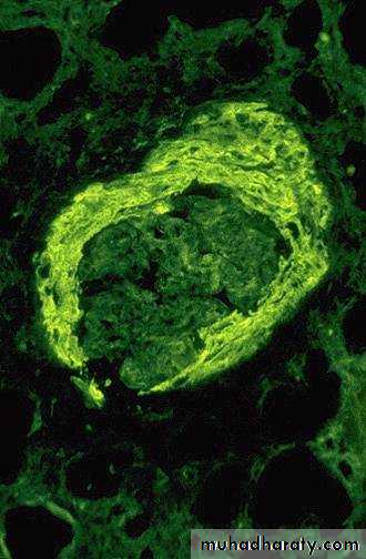 Renal