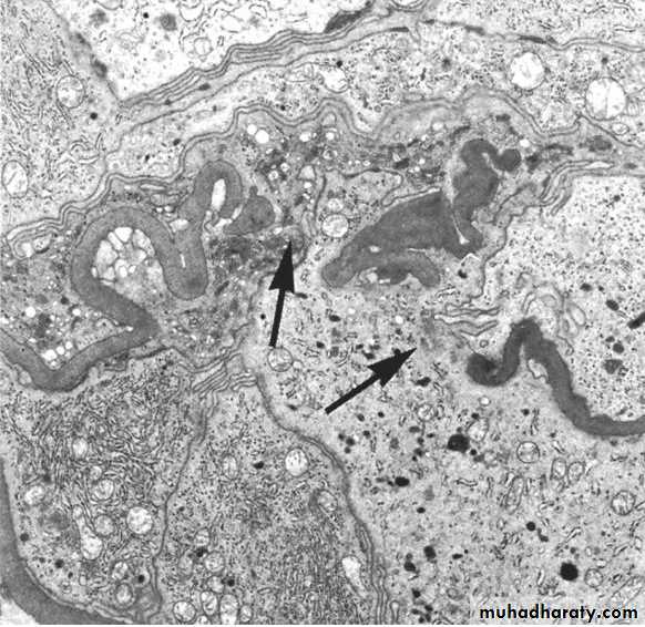 Renal