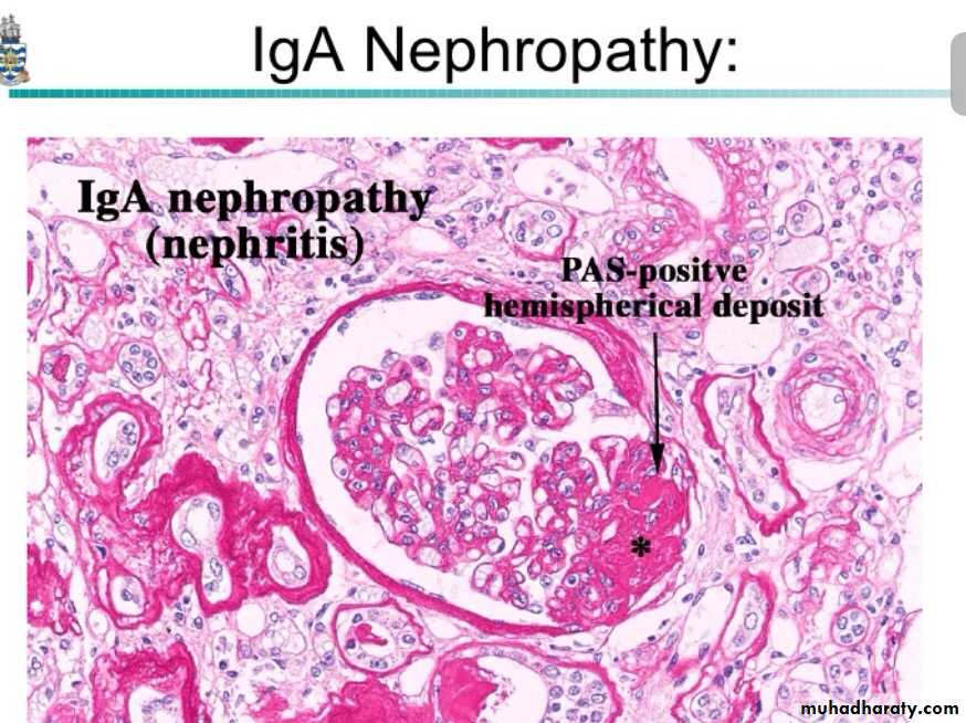 Renal