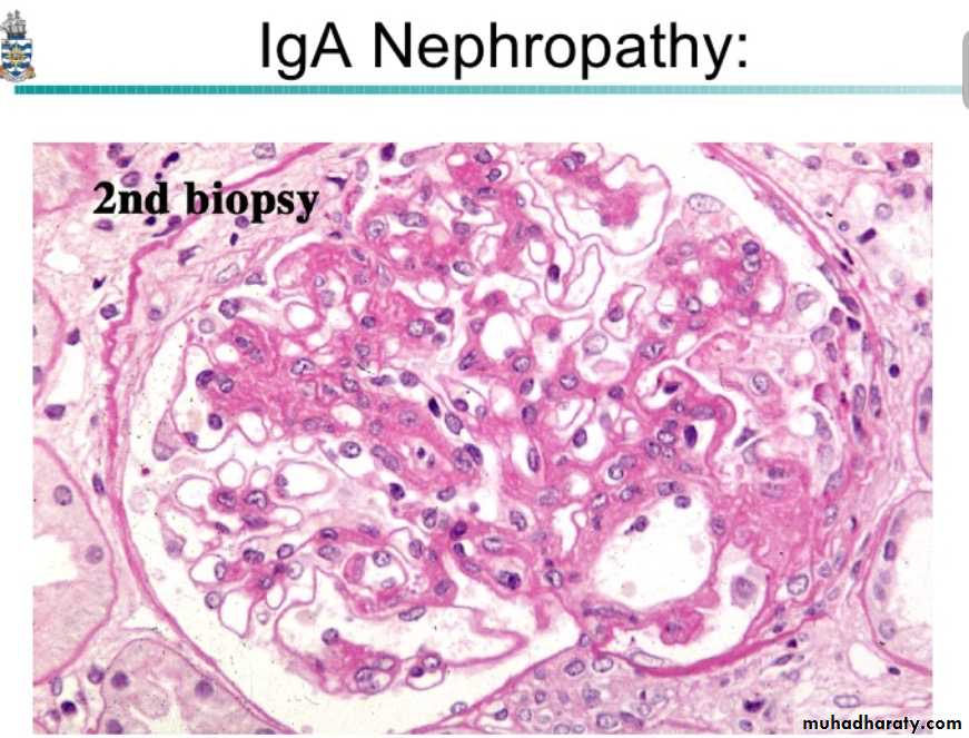 Renal