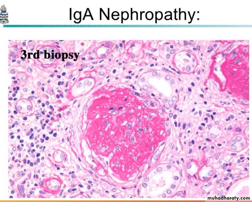 Renal