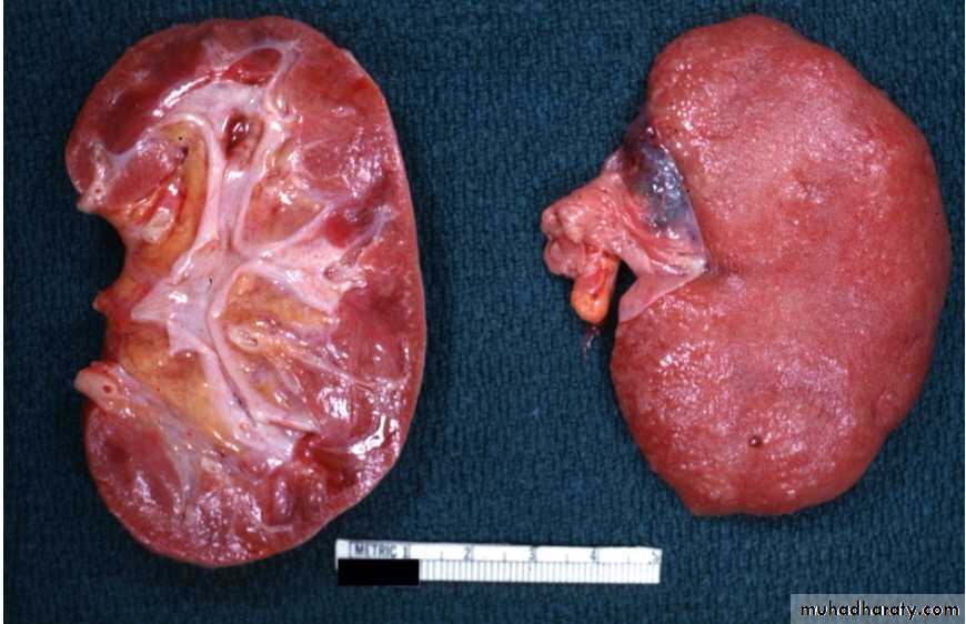 Renal