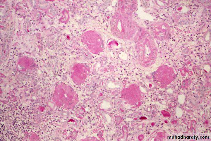 Renal