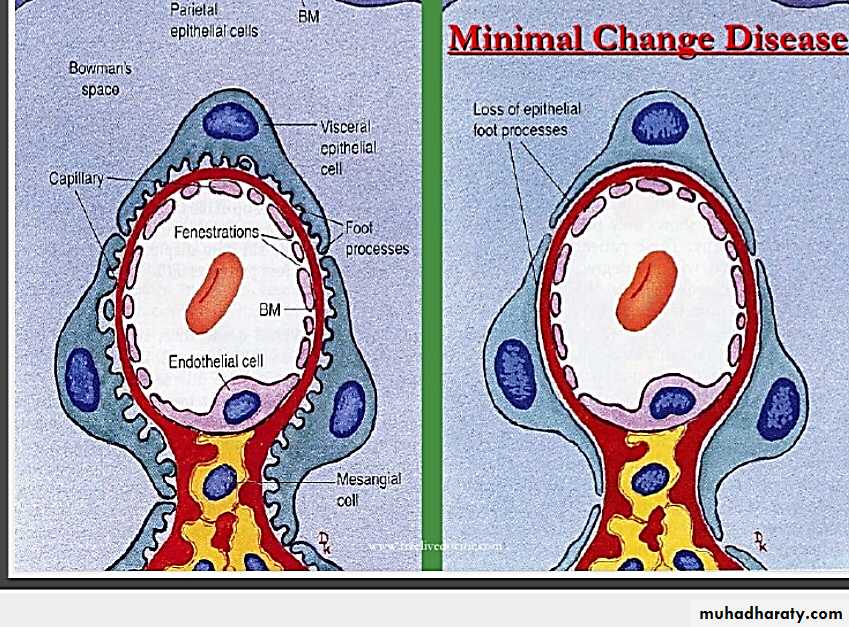 Renal