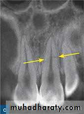 endodontic surgery