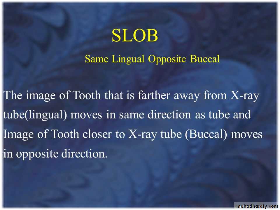 Impaction