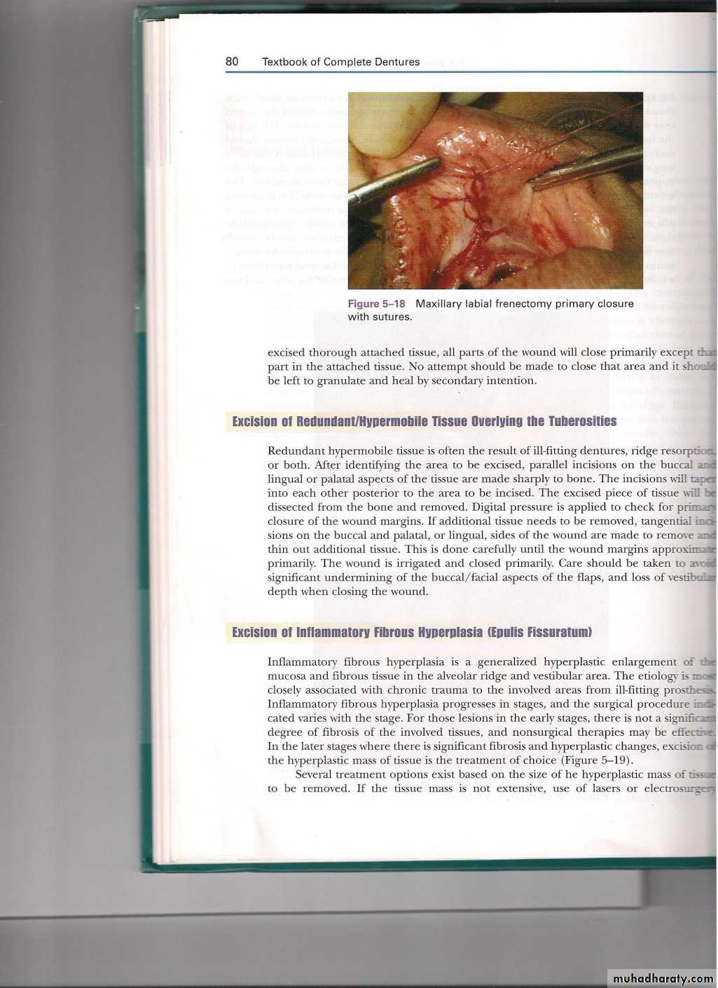 Pre-prosthetic surgical considerations