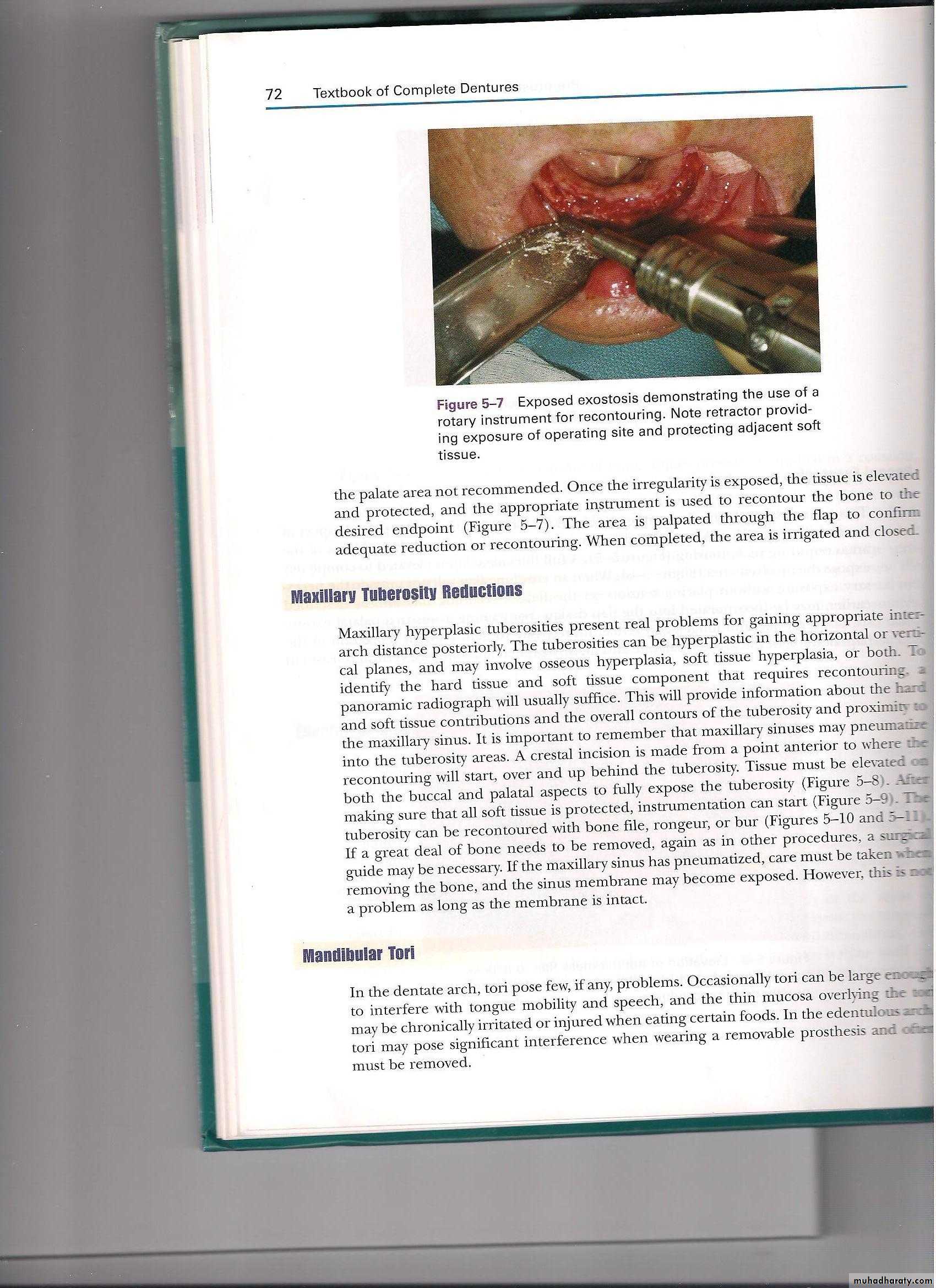 Pre-prosthetic surgical considerations