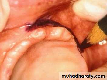 Pre-prosthetic surgical considerations