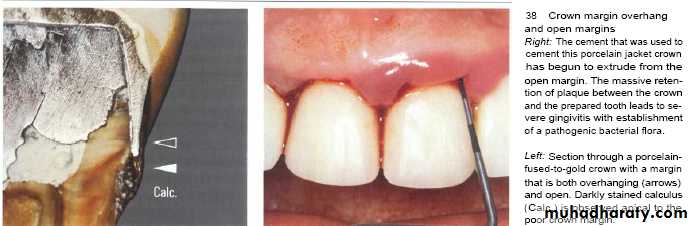 The predisposing factors for periodental diseases