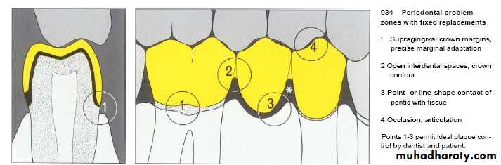 The predisposing factors for periodental diseases