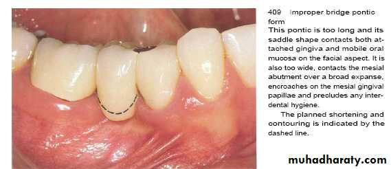 The predisposing factors for periodental diseases