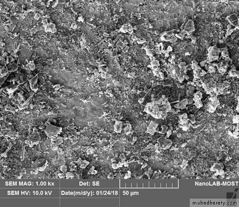 The predisposing factors for periodental diseases