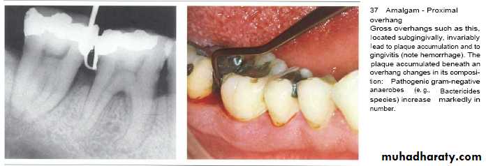 The predisposing factors for periodental diseases