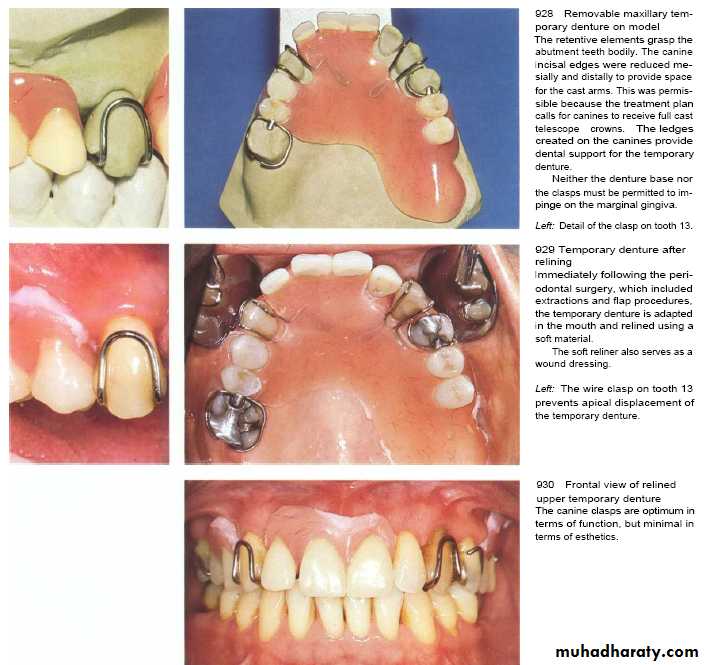 The predisposing factors for periodental diseases