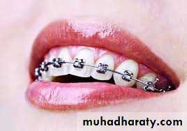 The predisposing factors for periodental diseases