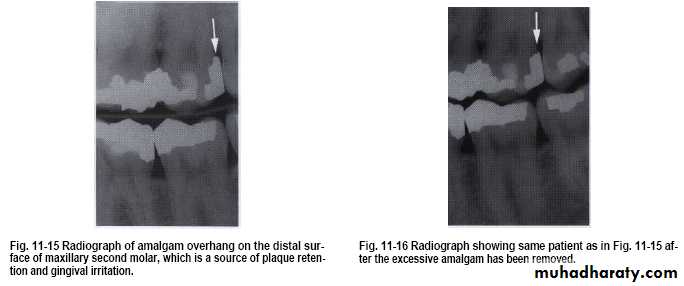 The predisposing factors for periodental diseases