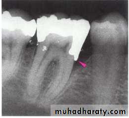 The predisposing factors for periodental diseases