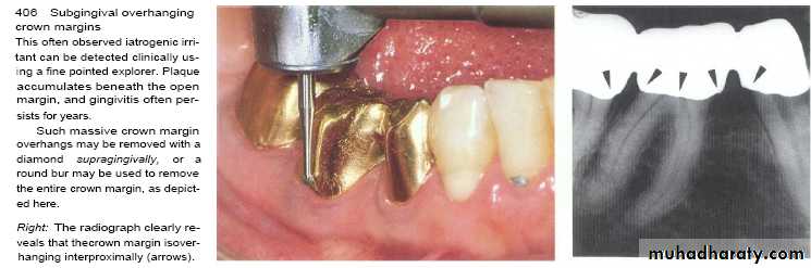 The predisposing factors for periodental diseases