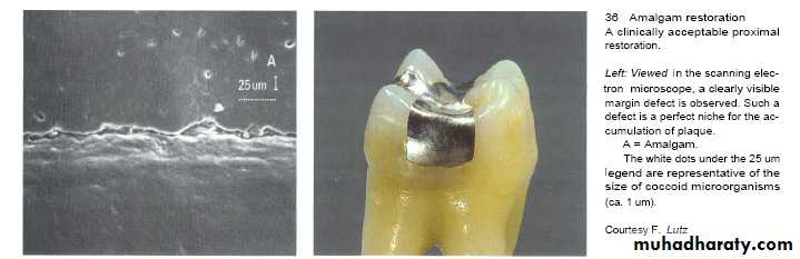 The predisposing factors for periodental diseases