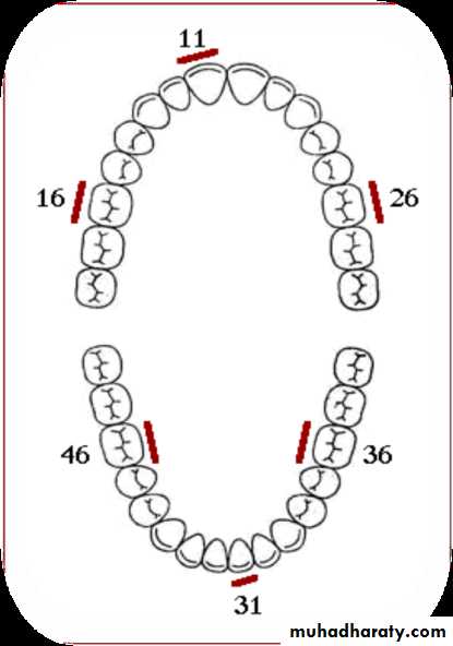 Periodontal indices