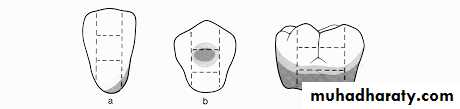 Periodontal indices
