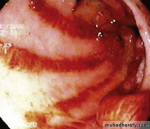 Autoimmune Connective Tissue Diseases-Part 2