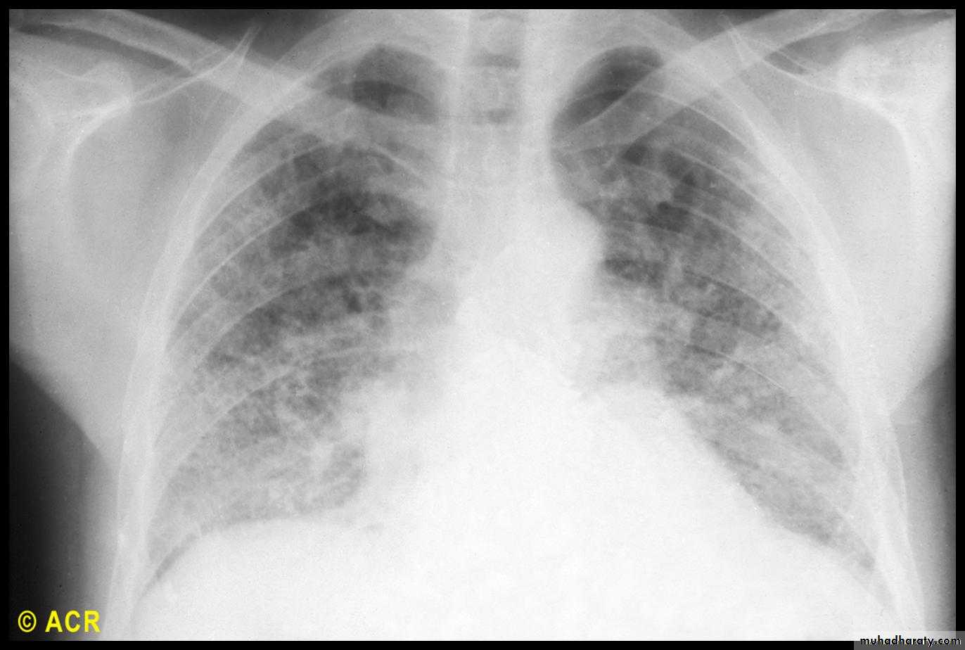 Autoimmune Connective Tissue Diseases-Part 2