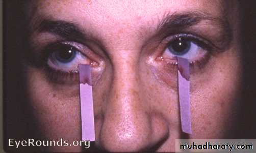Autoimmune Connective Tissue Diseases-Part 2