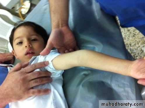 Elbow joint ملحق