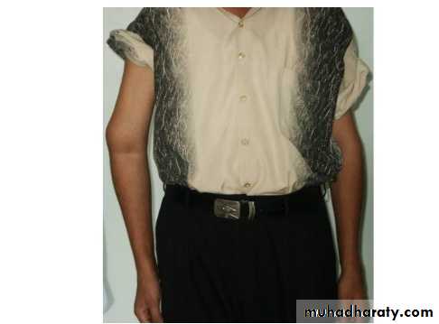 Elbow joint ملحق