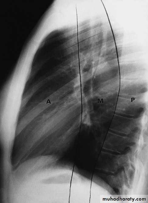 Mediastinum الاولى والثانية