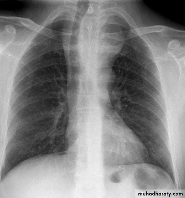 Mediastinum الاولى والثانية