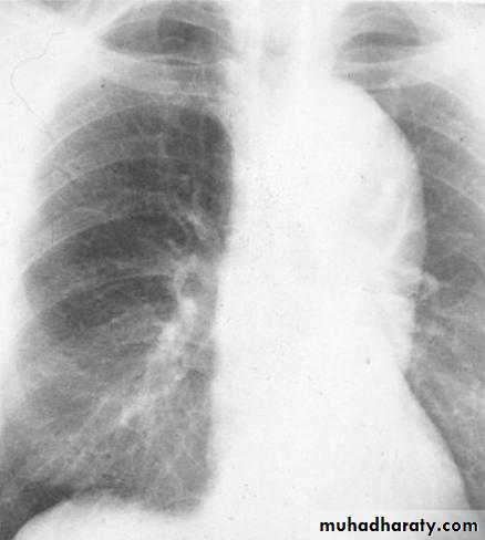 Mediastinum الاولى والثانية