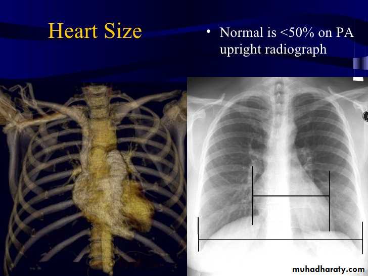 Mediastinum الاولى والثانية