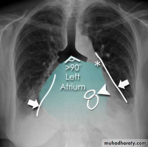 Mediastinum الاولى والثانية