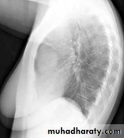 Mediastinum الاولى والثانية